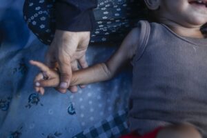 Trece millones de niños podrían sufrir malnutrición en África central y occidental en 2026