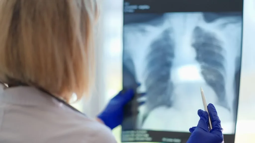 diferencias entre bronquitis y neumonia