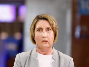 Primer trasplante facial del mundo con donante de eutanasia se realiza en Barcelona