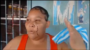 Joven denuncia intento de homicidio en Moca y pide protección a las autoridades