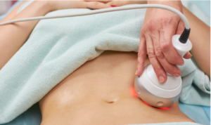 Alertan sobre peligros de masajes postquirúrgicos en personal no calificado