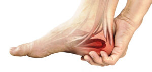 Talalgia: por qué duele el talón y cómo aliviarlo