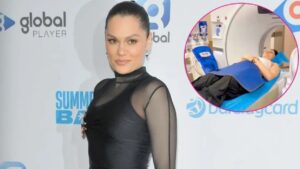 La cantante Jessie J fue hospitalizada de urgencia tras sufrir un fuerte golpe en su cabeza