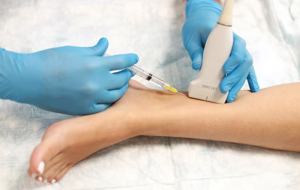 Advierten aumento de enfermedades venosas en RD