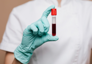 Nuevo análisis de sangre promete detectar el cáncer