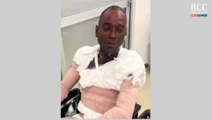 Fallece hombre tras permanecer hospitalizado por quemaduras graves