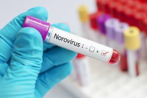 Más de 100 casos de norovirus en crucero que salió de California y regresó a San Francisco